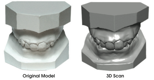 Digital Study Models Tuccini Orthodontic Laboratory